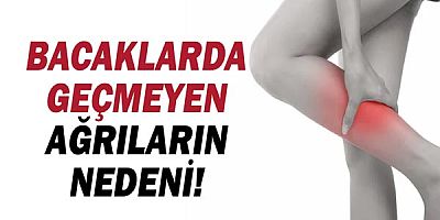 Bacaklarda geçmeyen ağrıların nedeni; Varis