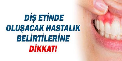  Diş Etinde Oluşacak Hastalık Belirtilerine Dikkat!