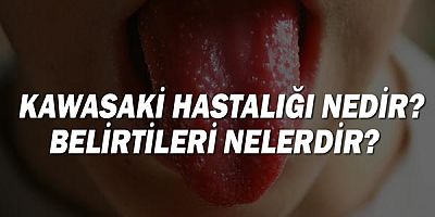  Kawasaki Hastalığı Nedir? Belirtileri Nelerdir? 