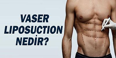  Vaser Liposuction Nedir? 