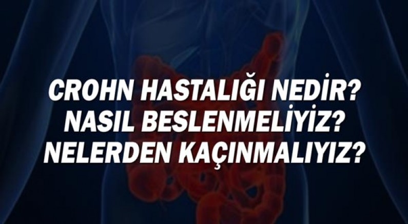 Crohn Hastalığı Nedir? Nasıl Beslenmeliyiz? Nelerden Kaçınmalıyız?