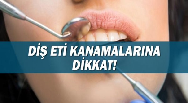 dis-eti-kanamalarina-dikkat-edilmeli.jpg