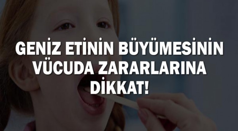 Geniz etinin büyümesinin vücuda zararlarına dikkat!