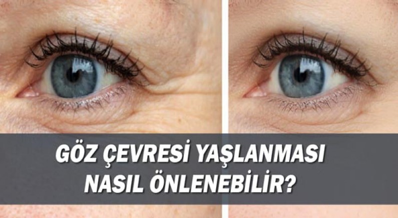Göz çevresi yaşlanması nasıl önlenebilir?