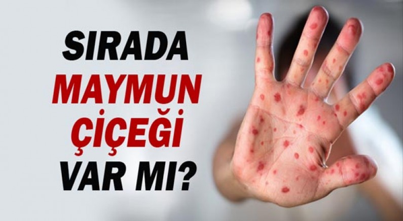 Sırada Maymun Çiçeği var mı?