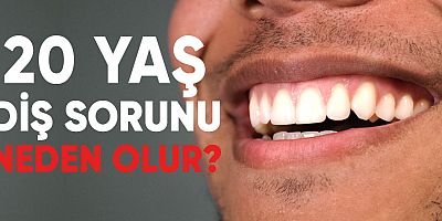 20 Yaş Diş Sorunu Neden Olur? Nelere Dikkat Edilmeli?