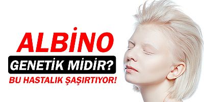 Albino hastalığı