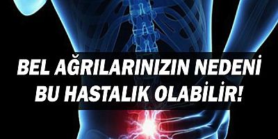 Bel ağrılarınızın nedeni bu hastalık olabilir!