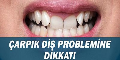 Çarpık Diş Problemine Dikkat!