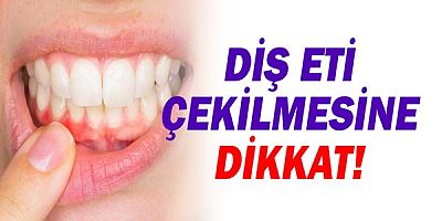  Diş Eti Çekilmesine Dikkat!