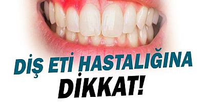  Diş Eti Hastalığına Dikkat!