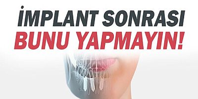 Diş İmplantı Sonrası Nelere Dikkat Edilmeli?