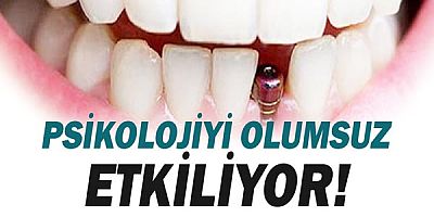  Diş Kayıpları Psikolojiyi Olumsuz Etkiliyor!