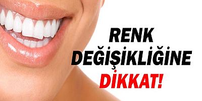  Dişlerde Renk Değişikliğine Dikkat!