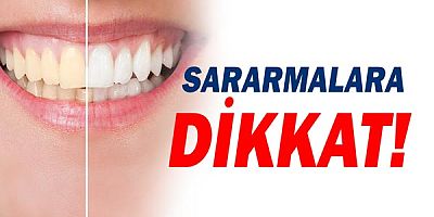  Dişlerdeki Sararmalara Dikkat!