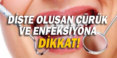 Dişte oluşan çürük ve enfeksiyona dikkat!