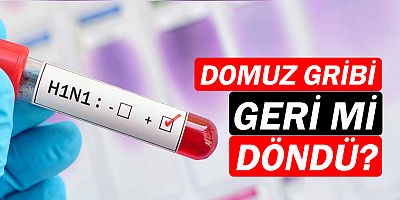 Domuz gribi