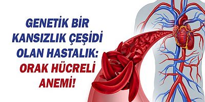 Genetik Bir Kansızlık Çeşidi Olan Hastalık: Orak Hücreli Anemi