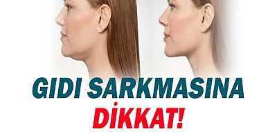  Gıdı Bölgesindeki Sarkmalara Dikkat!