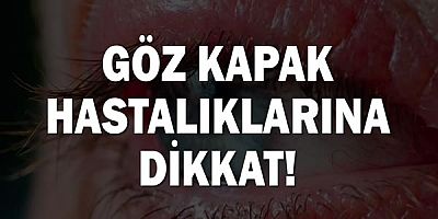 Göz Kapak Hastalıklarına Dikkat!