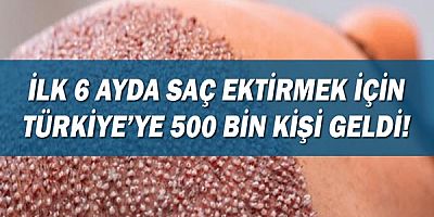 İlk 6 ayda saç ektirmek için Türkiye’ye 500 bin kişi geldi!