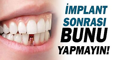 İmplant Yaptırdıktan Sonra Bunu yapmayın!