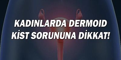 Kadınlarda Dermoid Kist Sorununa Dikkat!