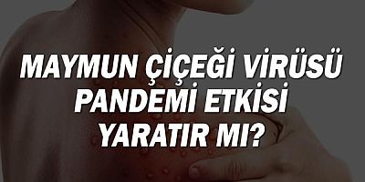 Maymun Çiçeği Virüsü Pandemi Etkisi Yaratır Mı?