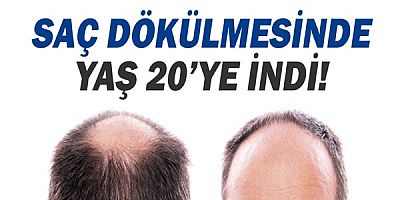 Saç Dökülme Yaşı 20 ye İndi!
