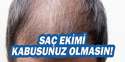 Saç Ekimi Kâbusunuz Olmasın!