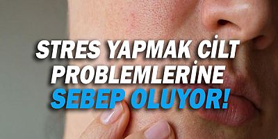 Stres Yapmak Cilt Problemlerine Sebep Oluyor!