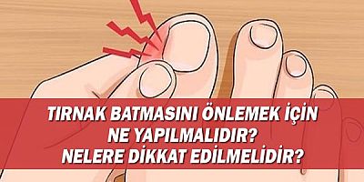 Tırnak Batmasını Önlemek İçin Ne Yapılmalıdır? Nelere Dikkat Edilmelidir?