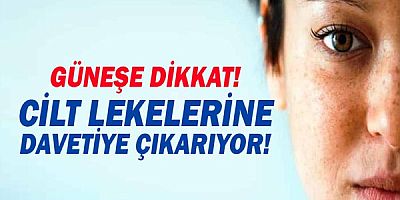 Uzmanı uyardı: Güneş ışınları cilt lekelerine davetiye çıkarıyor