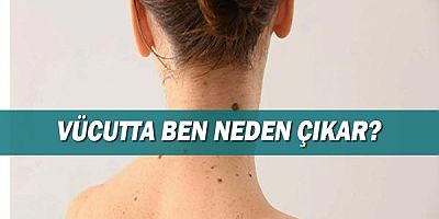 Vücutta Ben Neden Çıkar?