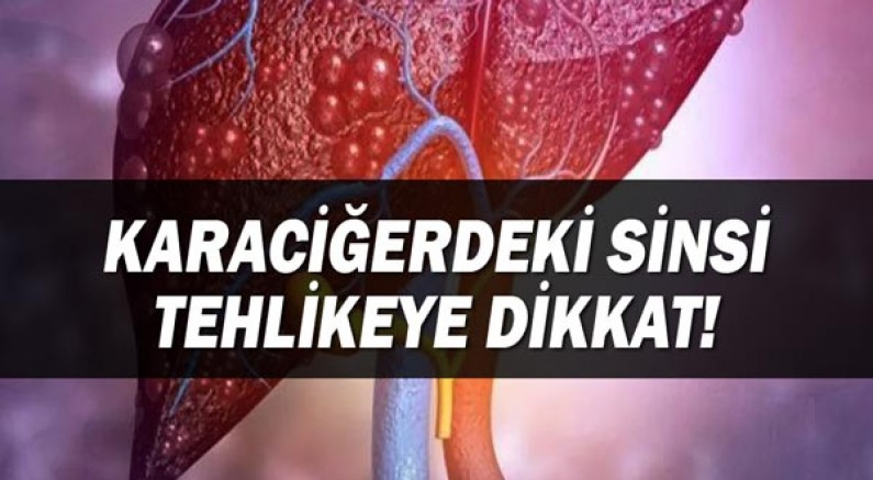 Türkiye’de her 4 kişiden birinin karaciğeri yağlı!